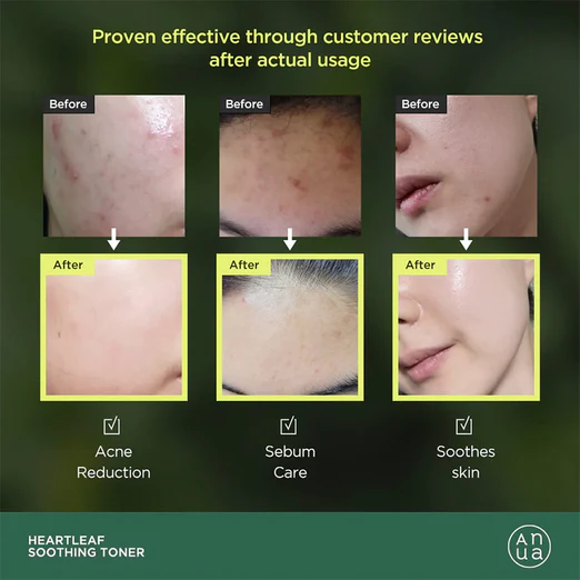 Heartleaf 77% Soothing Toner 40 mL