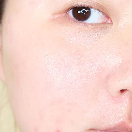 1025 Dokdo Mascarilla Gel