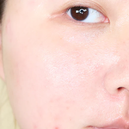 1025 Dokdo Mascarilla Gel